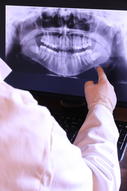 Best Dental Abscess Treatment in Blackville, SC